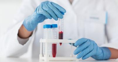 Ingyenes C-hepatitisz vizsgálat Kolozsváron