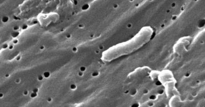 Néhány év alatt ellenállóvá válhat egy baktérium