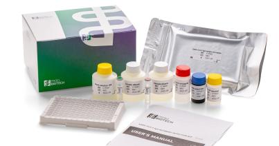 Erdélyi magyar kutatók saját fejlesztésű, koronavírus-antitesteket kimutató tesztet készítettek