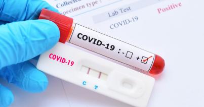 Módosultak a Covid-19  miatti elszigetelés szabályai